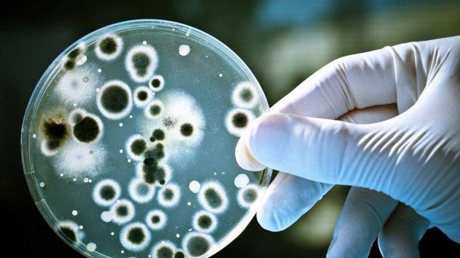 AI дизајнира целосно нови вирусни геноми, 16 погодни за уништување на Escherichia coli