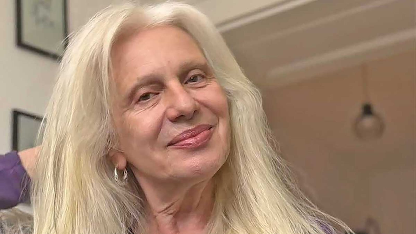 Maja Odžaklievska: I thought I had cancer after severe hair loss